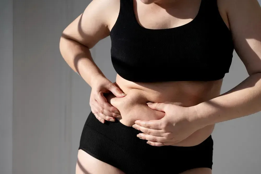Mulher aperta gordura abdominal. A imagem representa uma paciente com Síndrome de Cushing.